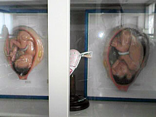 1.胎児.jpg